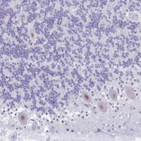 Anti-GLB1L2 antibody produced in rabbit 