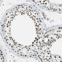 Anti-GLI3 antibody produced in rabbit