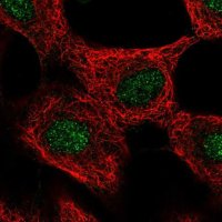 Anti-GLI4 antibody produced in rabbit 