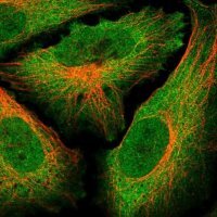 Anti-GLIS2 antibody produced in rabbit