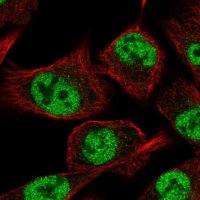 Anti-GLIS3 antibody produced in rabbit 