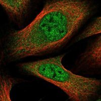 Anti-GLMN antibody produced in rabbit