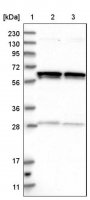 Anti-GLMN antibody produced in rabbit