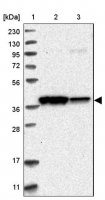 Anti-GLRX3 antibody produced in rabbit HPA028941-100UL