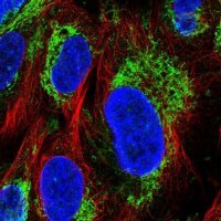 Anti-GLUD1 antibody produced in rabbit 