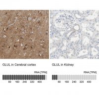 Anti-GLUL antibody produced in rabbit 
