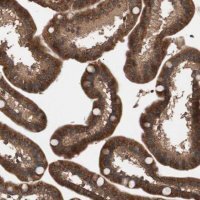 Anti-GLYCTK antibody produced in rabbit HPA006913-100UL
