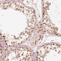 Anti-GMEB2 antibody produced in rabbit