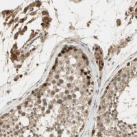 Anti-GMEB2 antibody produced in rabbit HPA009706-100UL