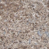 Anti-GNAI2 antibody produced in rabbit