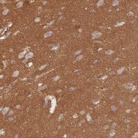 Anti-GNB4 antibody produced in rabbit HPA040736-100UL