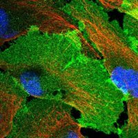 Anti-GNB4 antibody produced in rabbit HPA040736-100UL