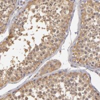 Anti-GNPDA1 antibody produced in rabbit HPA000499-100UL