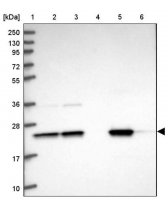 Anti-GNPNAT1 antibody produced in rabbit HPA044647-100UL