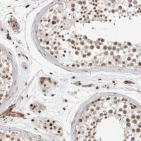 Anti-GPATCH2 antibody produced in rabbit