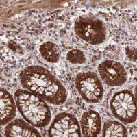 Anti-GPATCH8 antibody produced in rabbit