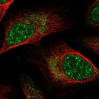 Anti-GPATCH8 antibody produced in rabbit
