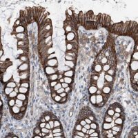 Anti-GPR142 antibody produced in rabbit 