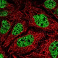 Anti-GPS2 antibody produced in rabbit 