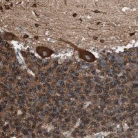 Anti-GPSM2 antibody produced in rabbit