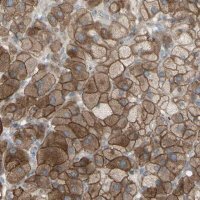 Anti-GRAMD1B antibody produced in rabbit 