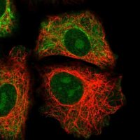 Anti-GRAMD1B antibody produced in rabbit 