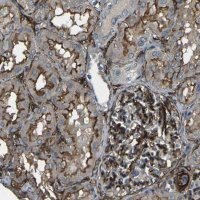 Anti-GRAMD1C antibody produced in rabbit 
