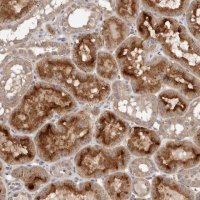 Anti-GRAMD2 antibody produced in rabbit 