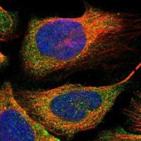 Anti-GRHPR antibody produced in rabbit 