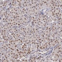 Anti-GRK3 antibody produced in rabbit 