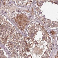 Anti-GSKIP antibody produced in rabbit