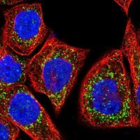 Anti-GSTK1 antibody produced in rabbit 