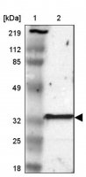 Anti-GSTT2B antibody produced in rabbit HPA000750-100UL