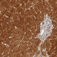 Anti-GSTZ1 antibody produced in rabbit HPA004701-100UL
