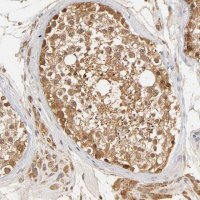 Anti-GSTZ1 antibody produced in rabbit HPA004701-100UL