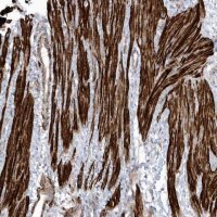 Anti-GTDC1 antibody produced in rabbit HPA036694-100UL
