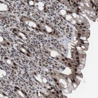 Anti-GTF2F2 antibody produced in rabbit