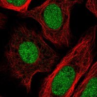 Anti-GTF2IRD2B antibody produced in rabbit 
