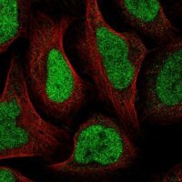Anti-GTF2IRD2B antibody produced in rabbit 