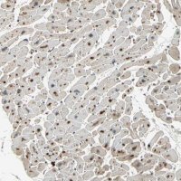Anti-GTF3A antibody produced in rabbit 