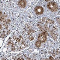 Anti-GTF3C1 antibody produced in rabbit 