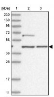 Anti-GTF3C2 antibody produced in rabbit 