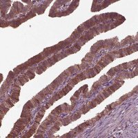 Anti-GTPBP1 antibody produced in rabbit 