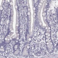 Anti-GUCA1A antibody produced in rabbit