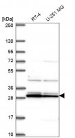 Anti-GUCA1B antibody produced in rabbit HPA055479-100UL