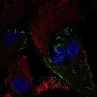 Anti-GUCA1C antibody produced in rabbit