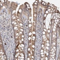 Anti-GUCY2C antibody produced in rabbit 