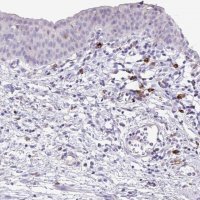 Anti-HACD4 antibody produced in rabbit HPA058666-100UL