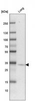 Anti-HACD4 antibody produced in rabbit HPA058666-100UL