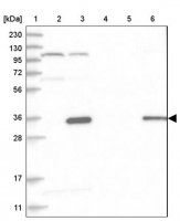 Anti-HAUS4 antibody produced in rabbit HPA029803-100UL